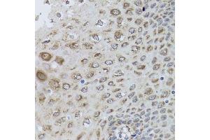 Immunohistochemistry of paraffin-embedded human esophagus using PRKAB1 antibody. (PRKAB1 Antikörper  (AA 1-80))