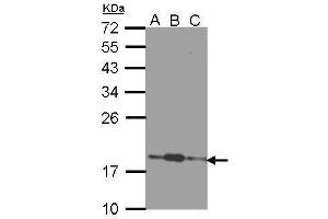 WB Image Sample (30 ug of whole cell lysate) A: 293T B: A431 , C: H1299 12% SDS PAGE antibody diluted at 1:1000 (COMMD7 Antikörper)