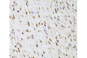 Immunohistochemistry of paraffin-embedded Human leiomyoma of uterus using SEPHS1 Polyclonal Antibody at dilution of 1:100 (40x lens). (SEPHS1 Antikörper)