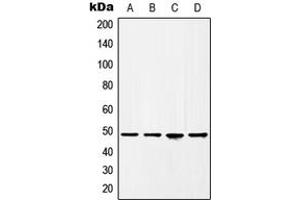 Western blot analysis of HAT1 expression in HeLa (A), BT20 (B), A431 (C), HEK293T (D) whole cell lysates.