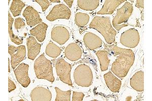 ABIN6259435 and ABIN6276265 at 1/100 staining rat muscle tissue by IHC-P.