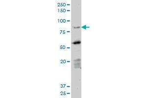 Western Blotting (WB) image for anti-Deleted in Azoospermia 1 (DAZ1) (AA 21-121) antibody (ABIN598639) (DAZ1 Antikörper  (AA 21-121))
