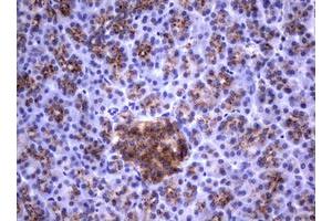 Image no. 6 for anti-Sialidase 1 (Lysosomal Sialidase) (NEU1) (AA 48-315) antibody (ABIN1491548)