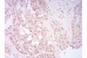 Immunohistochemistry (IHC) image for anti-Sirtuin 7 (SIRT7) (AA 1-105) antibody (ABIN5542445)