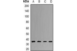 Western blot analysis of UCH-L5 expression in HT29 (A), Hela (B), mouse liver (C), rat brain (D) whole cell lysates. (UCHL5 Antikörper)