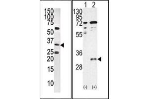 Image no. 1 for anti-CTD (Carboxy-terminal Domain, RNA Polymerase II, Polypeptide A) Small Phosphatase 1 (CTDSP1) (AA 1-250), (C-Term), (N-Term) antibody (ABIN360805) (CTDSP1 Antikörper  (C-Term, N-Term))
