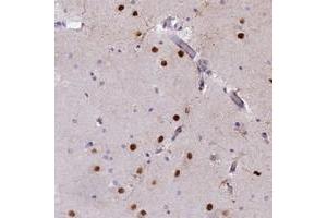 Immunohistochemical staining of human hippocampus with XKR9 polyclonal antibody  shows strong nuclear positivity in neuronal cells. (XKR9 Antikörper)