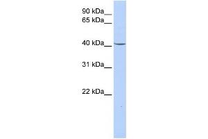 Western Blotting (WB) image for anti-Glycerol-3-Phosphate Dehydrogenase 1 (Soluble) (GPD1) antibody (ABIN2458632) (GPD1 Antikörper)