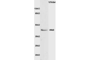 Rat liver lysate probed with Anti VASH1 Polyclonal Antibody, Unconjugated  at 1:3000 for 90 min at 37˚C.