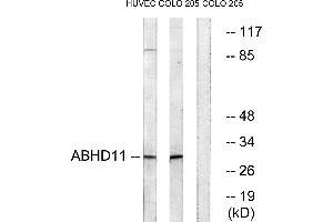 Western blot analysis of extracts from HUVEC cells and COLO cells, using ABHD11 antibody. (ABHD11 Antikörper)