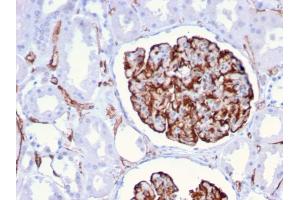 Immunohistochemistry (IHC) image for anti-Nestin (NES) (AA 698-844) antibody (ABIN6939087)