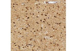 IHC analysis of HES5 using anti-HES5 antibody (ABIN7598966).