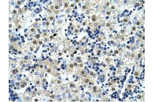 NFYC antibody was used for immunohistochemistry at a concentration of 4-8 ug/ml to stain Hepatocytes (arrows) in Human Liver. (NFYC Antikörper  (C-Term))