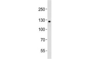 Western blot analysis of lysate from K562 cell line using LIFR antibody diluted at 1:1000. (LIFR Antikörper  (C-Term))