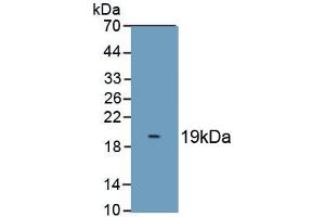 Detection of Recombinant S100A8, Cattle using Polyclonal Antibody to S100 Calcium Binding Protein A8 (S100A8) (S100A8 Antikörper  (AA 1-89))