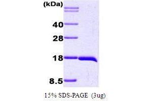 Figure annotation denotes ug of protein loaded and % gel used. (Interleukin 1, beta (IL1B) (AA 117-269) Peptid)