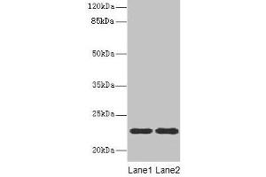 Western blot All lanes: ASF1B antibody at 13 μg/mL Lane 1: MCF-7 whole cell lysate Lane 2: Jurkat whole cell lysate Secondary Goat polyclonal to rabbit IgG at 1/10000 dilution Predicted band size: 23 kDa Observed band size: 23 kDa (ASF1B Antikörper  (AA 1-202))
