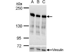 WB Image Ribosome binding protein 1 antibody validation by siRNA knock-down.