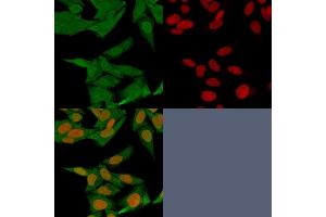 Immunofluorescence (IF) image for anti-S100 Calcium Binding Protein A4 (S100A4) (AA 1-200) antibody (ABIN6940541)