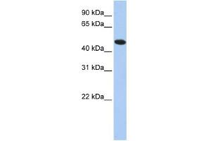 WB Suggested Anti-TXNDC5 Antibody Titration: 0. (TXNDC5 Antikörper  (N-Term))