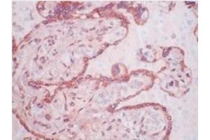 Immunohistochemistry (IHC) image for anti-Matrix Metallopeptidase 11 (Stromelysin 3) (MMP11) antibody (ABIN781659) (MMP11 Antikörper)