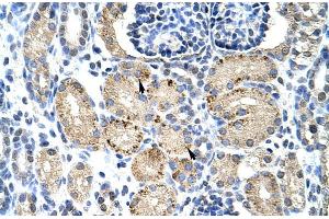 Rabbit Anti-ELL Antibody Catalog Number: ARP30105 Paraffin Embedded Tissue: Human Kidney Cellular Data: Epithelial cells of renal tubule Antibody Concentration: 4. (ELL Antikörper  (C-Term))