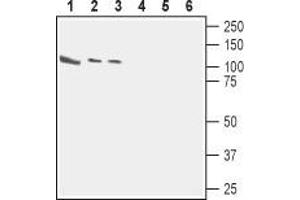 Western blot analysis of rat brain (lanes 1 and 4), mouse brain (lanes 2 and 5) and human neuroblastoma (SH-SY5Y) (lanes 3 and 6) cell line lysates: - 1,2. (CASK Antikörper  (Intracellular))