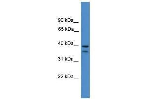 SERPINB6 antibody used at 0. (SERPINB6 Antikörper  (Middle Region))
