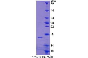 Image no. 1 for Cartilage Oligomeric Matrix Protein (COMP) (AA 123-240) protein (His tag) (ABIN6236725) (COMP Protein (AA 123-240) (His tag))