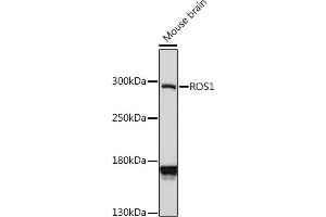 Western Blotting (WB) image for anti-C-Ros Oncogene 1 , Receptor tyrosine Kinase (ROS1) (AA 2100-2200) antibody (ABIN7265974)