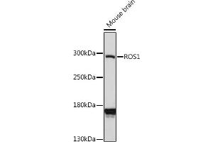 Western blot analysis of extracts of mouse brain, using ROS1 antibody (ABIN7265974) at 1:1000 dilution.