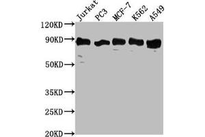 Western Blot Positive WB detected in: Jurkat whole cell lysate, PC3 whole cell lysate, MCF-7 whole cell lysate, K562 whole cell lysate, A549 whole cell lysate All lanes: BRAT1 antibody at 1:2000 Secondary Goat polyclonal to rabbit IgG at 1/50000 dilution Predicted band size: 89, 31, 32 kDa Observed band size: 89 kDa (BAAT1 Antikörper  (AA 603-821))
