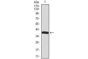 Western blot analysis using SST mAb against human SST recombinant protein. (Somatostatin Antikörper  (AA 1-116))