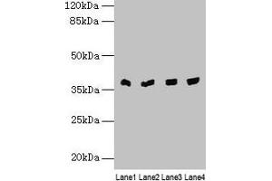 Western blot All lanes: TALDO1 antibody at 0.