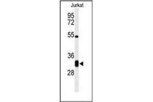 Western blot analysis of CPSF4 Antibody (Center) in Jurkat cell line lysates (35ug/lane).