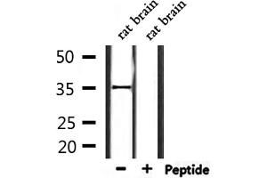 Western blot analysis of extracts from rat brain, using OR2L2 Antibody. (OR2L2 Antikörper)