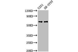 Western Blot Positive WB detected in: U251 whole cell lysate, SH-SY5Y whole cell lysate All lanes: Nox4 antibody at 3. (NADPH Oxidase 4 Antikörper  (AA 210-424))