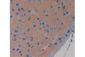 Used in DAB staining on fromalin fixed paraffin- embedded brain tissue (CHRDL1 Antikörper  (AA 272-447))