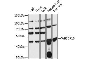 Western blot analysis of extracts of various cell lines, using WBSCR16 antibody (ABIN7271367) at 1:3000 dilution. (WBSCR16 Antikörper  (AA 1-230))