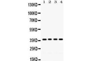 Western Blotting (WB) image for anti-Forkhead Box A3 (FOXA3) (AA 291-324), (C-Term) antibody (ABIN3042401)