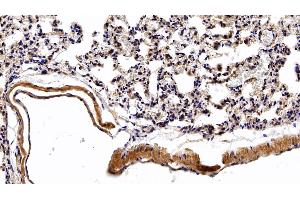 Immunohistochemistry (IHC) image for anti-Vascular Endothelial Growth Factor A (VEGFA) (AA 27-190) antibody (ABIN7429451)
