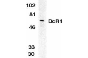Image no. 1 for anti-Tumor Necrosis Factor Receptor Superfamily, Member 10c (TNFRSF10C) (Extracellular Domain) antibody (ABIN203554) (DcR1 Antikörper  (Extracellular Domain))