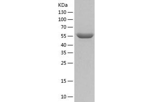 PKM2 Protein (AA 1-531) (His tag)