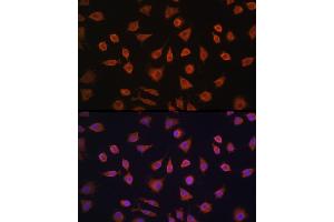 Immunofluorescence analysis of L929 cells using PFKFB2 Rabbit pAb (ABIN6129842, ABIN6145483, ABIN6145484 and ABIN6224971) at dilution of 1:100 (40x lens). (PFKFB2 Antikörper  (AA 446-505))