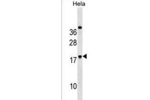 RN Antibody (Center) (ABIN1538629 and ABIN2850418) western blot analysis in Hela cell line lysates (35 μg/lane). (RNF224 Antikörper  (AA 79-105))