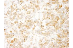 anti-Mitogen-Activated Protein Kinase Kinase Kinase MLT (ZAK) (AA 750-800) antibody