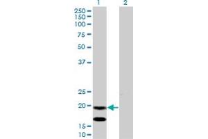 Western Blot analysis of EMP3 expression in transfected 293T cell line by EMP3 monoclonal antibody (M01), clone 3D4.