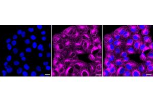 anti-Mitogen-Activated Protein Kinase 10 (MAPK10) antibody