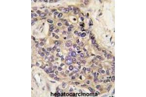Immunohistochemistry (IHC) image for anti-Hepatocyte Growth Factor (Hepapoietin A, Scatter Factor) (HGF) antibody (ABIN2999319) (HGF Antikörper)