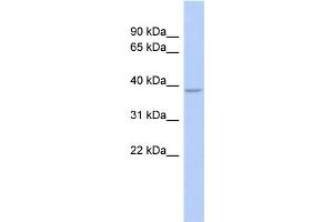 WB Suggested Anti-SOX7 Antibody Titration:  1 ug/ml  Positive Control:  Fetal Stomach cell lysate (SOX7 Antikörper  (Middle Region))